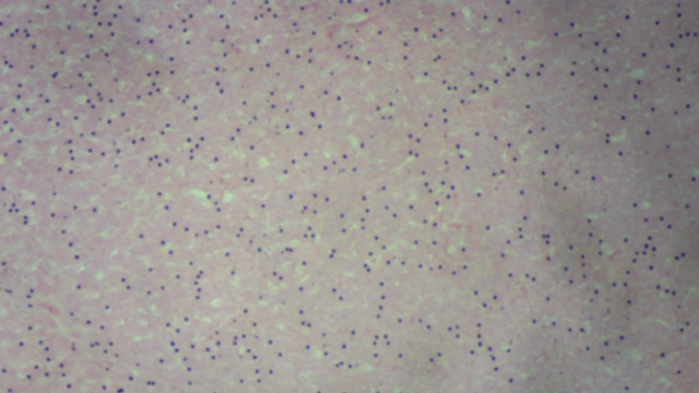 Coupe de foie — tissu hépatique (vue histologique)