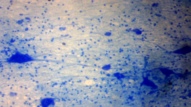 Neurocytes (neurones) — tissu nerveux (coupe histologique)